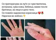 Krema Za Izgirenici