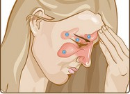 КАПКИ И МАСТ ЗА СИНУСИ и НОС